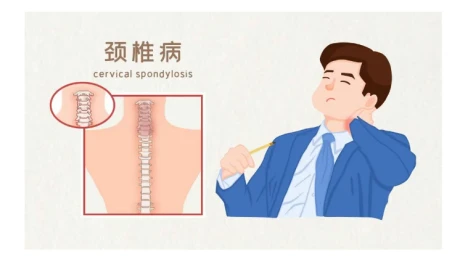 A proposito di insonnia? Hai considerato la causa del rachide cervicale?